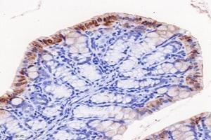 Immunohistochemistry analysis of paraffin-embedded mouse colon using,FGF10 (ABIN7073940) at dilution of 1: 8000 (FGF10 抗体)