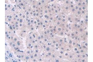 Immunohistochemistry (IHC) image for anti-Procollagen C-Endopeptidase Enhancer (PCOLCE) (AA 315-437) antibody (ABIN7433444)