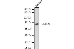 UGT1A1 抗体  (AA 1-200)