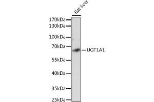 Western blot analysis of extracts of Rat liver, using UGT1 antibody (ABIN6132769, ABIN6149895, ABIN6149896 and ABIN6221779) at 1:2130 dilution. (UGT1A1 抗体  (AA 1-200))