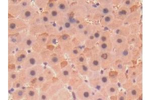 Immunohistochemistry (IHC) image for anti-Collagen, Type VIII, alpha 1 (COL8A1) (AA 575-743) antibody (ABIN7434713)
