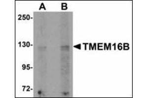Western blot analysis of TMEM16B in rat brain tissue lysate with TMEM16B antibody at (A) 1 and (B) 2 µg/ml. (Anoctamin 2 抗体  (N-Term))