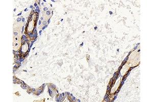 Immunohistochemistry analysis of paraffin-embedded mouse skin using CK-17 Polyclonal Antibody at dilution of 1:400. (KRT17 抗体)