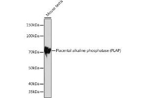 Western blot analysis of extracts of Mouse testis, using Placental alkaline phosphatase (PLAP) Rabbit mAb (ABIN1682693, ABIN7101664, ABIN7101665 and ABIN7101666) at 1:1000 dilution. (PLAP 抗体)