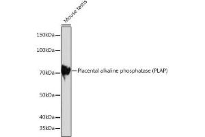 Western blot analysis of extracts of Mouse testis, using Placental alkaline phosphatase (PLAP) Rabbit mAb (ABIN1682693, ABIN7101664, ABIN7101665 and ABIN7101666) at 1:1000 dilution.
