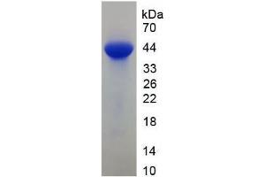 SDS-PAGE analysis of Mouse FABP3 Protein. (FABP3 蛋白)