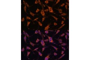 Immunofluorescence analysis of L929 cells using FBLN5 Polyclonal Antibody (ABIN6127927, ABIN6140497, ABIN6140498 and ABIN6225300) at dilution of 1:100 (40x lens). (Fibulin 5 抗体  (AA 199-448))