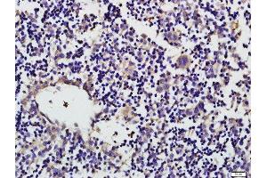 Paraformaldehyde-fixed, paraffin embedded mouse fetal liver tissue, Antigen retrieval by boiling in sodium citrate buffer(pH6) for 15min, Block endogenous peroxidase by 3% hydrogen peroxide for 30 minutes, Blocking buffer (normal goat serum) at 37°C for 20min, Antibody incubation with CD19 (Tyr531) Polyclonal Antibody, Unconjugated  at 1:500 overnight at 4°C, followed by a conjugated secondary and DAB staining (CD19 抗体  (pTyr531))