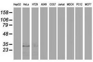 Image no. 2 for anti-Eukaryotic Translation Initiation Factor 4E Family Member 2 (EIF4E2) antibody (ABIN1497993) (EIF4E2 抗体)