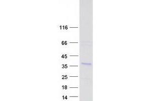 CHORDC1 Protein (Transcript Variant 2) (Myc-DYKDDDDK Tag)