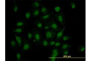 Immunofluorescence of monoclonal antibody to HIPK1 on HeLa cell. (HIPK1 抗体  (AA 330-430))