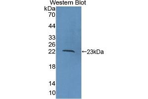 Detection of Recombinant COL16, Human using Polyclonal Antibody to Collagen Type XVI (COL16) (COL16 抗体  (AA 1434-1604))
