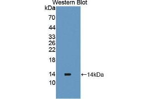 Western blot analysis of the recombinant protein. (PLOD2 抗体  (AA 644-737))