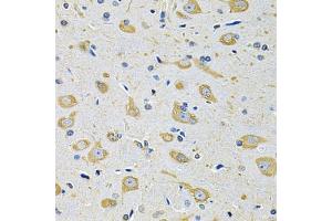 Immunohistochemistry of paraffin-embedded mouse brain using FASTKD1 Antibody (ABIN5975129) at dilution of 1/100 (40x lens). (FASTKD1 抗体)