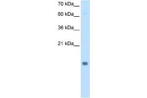 Cystatin B antibody used at 0. (CSTB 抗体)