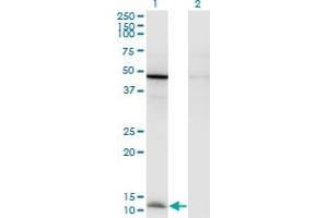 Western Blot analysis of CCL2 expression in transfected 293T cell line by CCL2 monoclonal antibody (M05), clone 1F10. (CCL2 抗体  (AA 1-99))