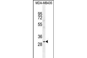 CLEC10A Antibody (N-term) (ABIN654515 and ABIN2844239) western blot analysis in MDA-M cell line lysates (35 μg/lane). (CLEC10A 抗体  (N-Term))