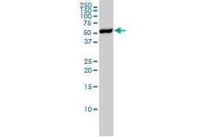 YES1 monoclonal antibody (M02), clone 3C6 Western Blot analysis of YES1 expression in Jurkat . (YES1 抗体  (AA 1-80))