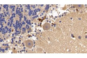Detection of a2M in Porcine Cerebellum Tissue using Polyclonal Antibody to Alpha-2-Macroglobulin (a2M) (alpha 2 Macroglobulin 抗体  (AA 616-856))