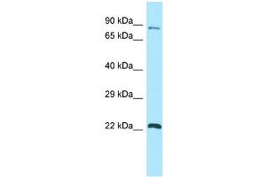 WB Suggested Anti-GPSM1 Antibody Titration: 1. (GPSM1 抗体  (C-Term))