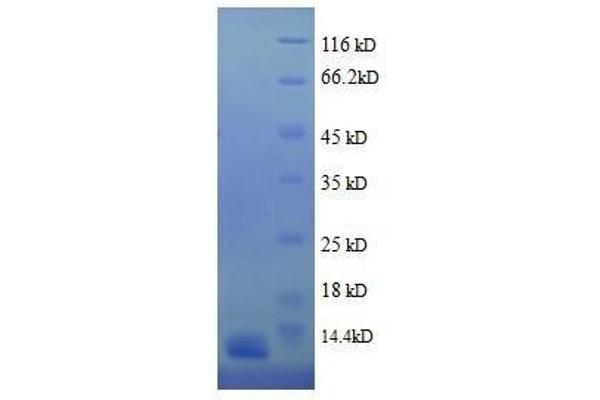 Hemoglobin Protein (full length)