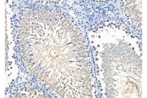 ABIN6264553 and ABIN6279706 at 1/100 staining Rat testis tissue by IHC-P.