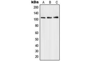 Western blot analysis of PMS1 expression in HepG2 (A), Molt4 (B), A549 (C) whole cell lysates. (PMS1 抗体  (Center))
