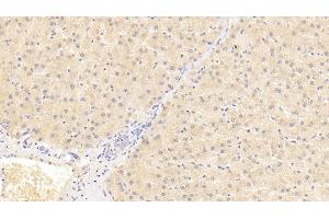 Detection of AT in Human Liver Tissue using Monoclonal Antibody to Antithrombin (AT) (SERPINC1 抗体)