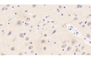 Detection of EFNA3 in Human Cerebrum Tissue using Polyclonal Antibody to Ephrin A3 (EFNA3) (Ephrin A3 抗体  (AA 30-238))