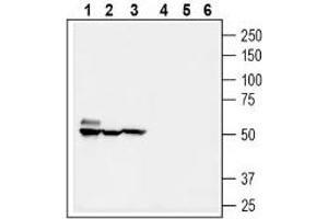 Western blot analysis of mouse brain lysate (lanes 1 and 4), rat kidney membranes (lanes 2 and 5) and mouse colon membranes (3 and 6): - 1-3. (SLC5A8 抗体  (C-Term, Intracellular))