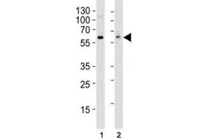 Western Blotting (WB) image for anti-Proto-oncogene tyrosine-protein kinase Src (Src) antibody (ABIN3029562)