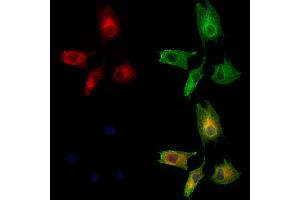 ABIN6260208 and ABIN6273200 staining HUVEC cells by IF/ICC. (BBS10 抗体  (Internal Region))