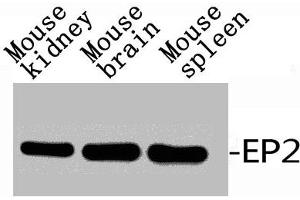 Western Blotting (WB) image for anti-Prostaglandin E Receptor 2 (Subtype EP2), 53kDa (PTGER2) (C-Term) antibody (ABIN7184873)