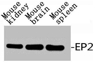 Western Blot analysis of RAT-KIDNEY MOUSE-BRAIN MOUSE-HEART using EP2 Polyclonal Antibody. (PTGER2 抗体  (C-Term))