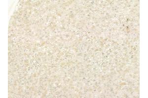 ABIN6257387 and ABIN6275304 at 1/100 staining human astrocytoma by IHC-P. (Neuromedin U 抗体  (C-Term))