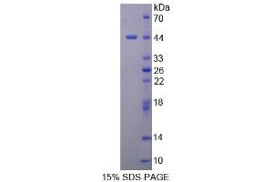 SDS-PAGE analysis of Mouse DHPS Protein. (DHPS 蛋白)