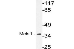 Western blot (WB) analysis of Meis1 antibody in extracts from Jurkat cells. (MEIS1 抗体)