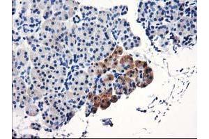 Immunohistochemical staining of paraffin-embedded Human pancreas tissue using anti-TBC1D21 mouse monoclonal antibody. (TBC1D21 抗体)