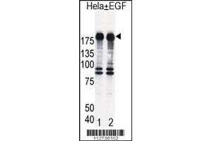 Western blot analysis of EGFR in Hela cell lysates, either induced (Lane 1) or noninduced with EGF (Lane 2). (EGF 抗体  (AA 1048-1077))