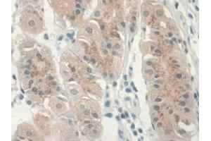 Detection of GREM1 in Human Stomach Tissue using Monoclonal Antibody to Gremlin 1 (GREM1) (GREM1 抗体  (AA 26-184))