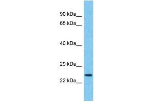 Western Blotting (WB) image for anti-Transmembrane Emp24 Protein Transport Domain Containing 5 (TMED5) (C-Term) antibody (ABIN2500383) (TMED5 抗体  (C-Term))
