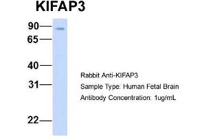 Host: Rabbit  Target Name: KIFAP3  Sample Tissue: Human Fetal Brain  Antibody Dilution: 1. (KIFAP3 抗体  (Middle Region))