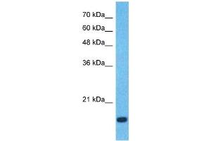 Host:  Rabbit  Target Name:  CCL18  Sample Type:  Fetal Lung lysates  Antibody Dilution:  0. (CCL18 抗体  (Middle Region))