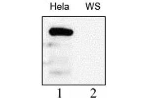 WRN antibody (mAb) tested by Western blot. (RECQL2 抗体)