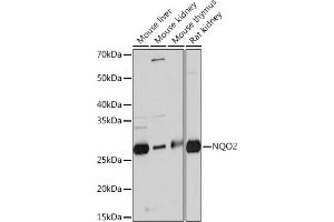 Western blot analysis of extracts of various cell lines, using NQO2 Rabbit mAb (ABIN7268962) at 1:1000 dilution. (NQO2 抗体)