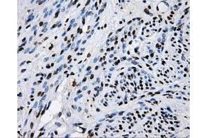 Immunohistochemical staining of paraffin-embedded endometrium tissue using anti-RALBP1mouse monoclonal antibody. (RALBP1 抗体)