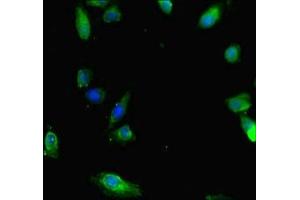 Immunofluorescent analysis of Hela cells using ABIN7160220 at dilution of 1:100 and Alexa Fluor 488-congugated AffiniPure Goat Anti-Rabbit IgG(H+L) (SMAD1 抗体  (AA 150-250))