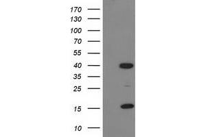 Western Blotting (WB) image for anti-PDZ and LIM Domain 2 (PDLIM2) antibody (ABIN1500126) (PDLIM2 抗体)