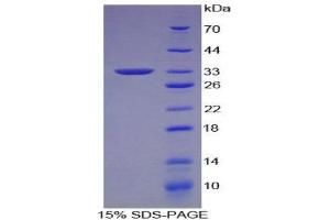 SDS-PAGE (SDS) image for Neural Cell Adhesion Molecule 1 (NCAM1) (AA 340-608) protein (His tag,T7 tag) (ABIN1879059) (CD56 Protein (AA 340-608) (His tag,T7 tag))