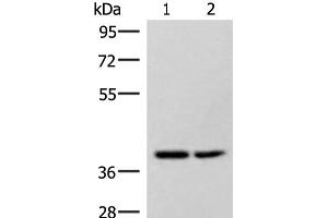 Western blot analysis of Hela and 231 cell lysates using HPDL Polyclonal Antibody at dilution of 1:400 (HPDL 抗体)